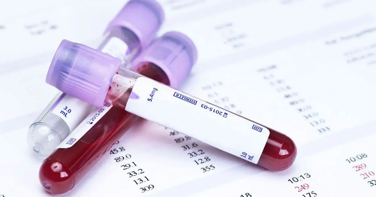 blood test