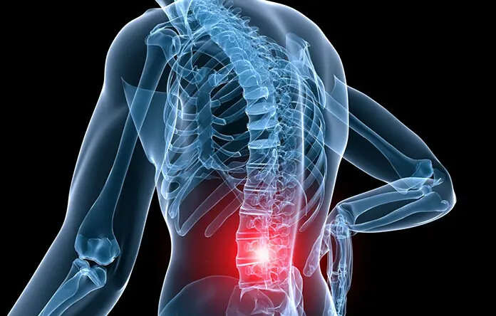 Senaman Efektif untuk Meredakan Sakit Belakang: Panduan Komprehensif 1 low back pain