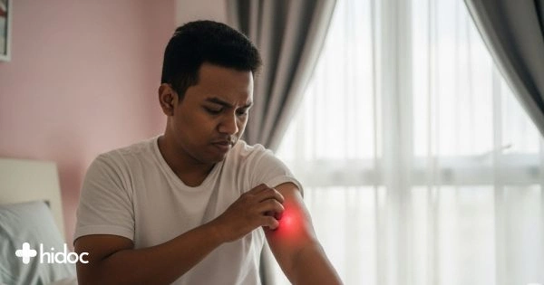 Penyakit Kulit: Jenis, Rawatan, dan Pencegahan
