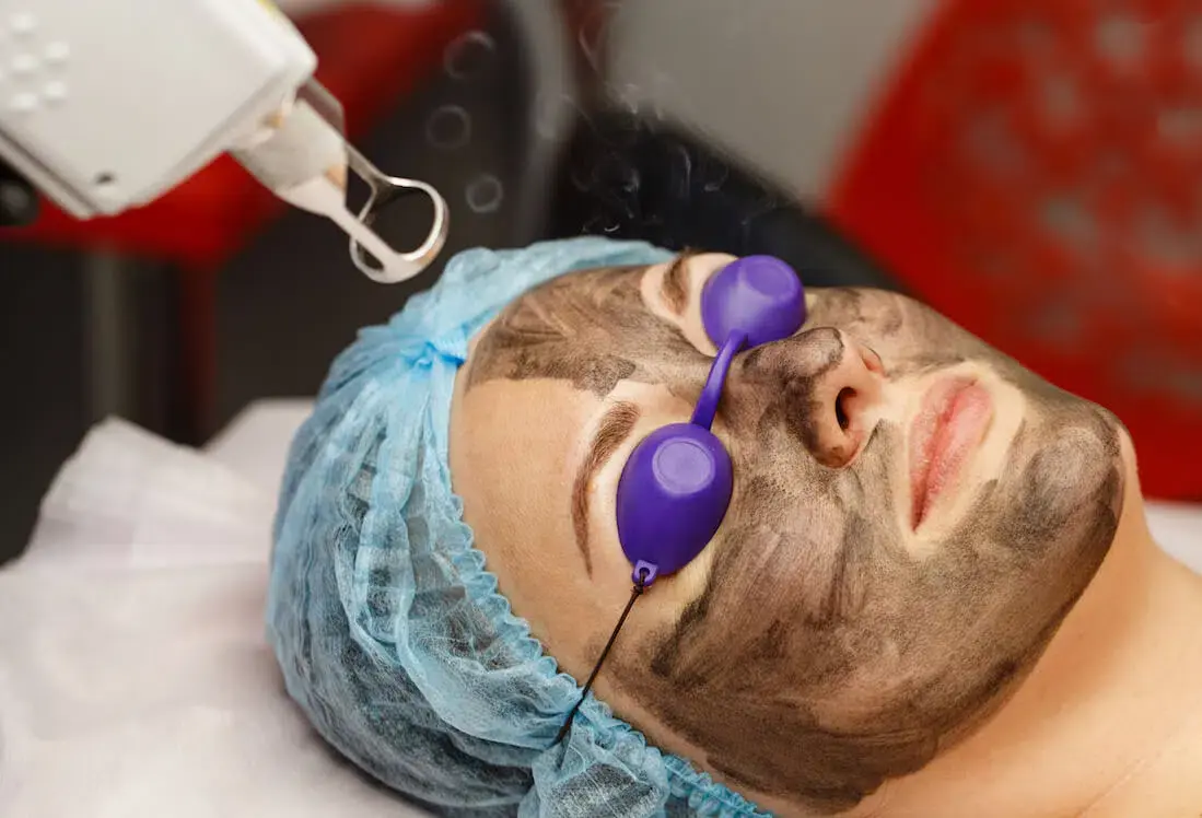 Ubat Jeragat: Panduan Lengkap untuk Mengatasi Masalah Jeragat pada Kulit 4 rawatan laser